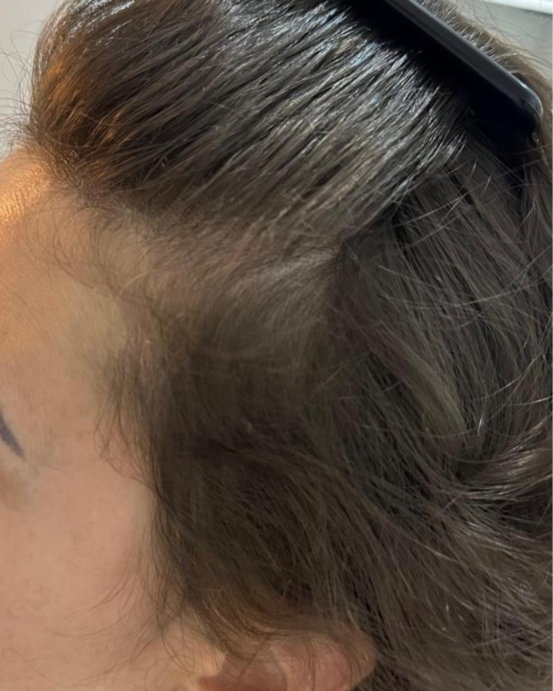 Tratamento capilar antes e depois (10)