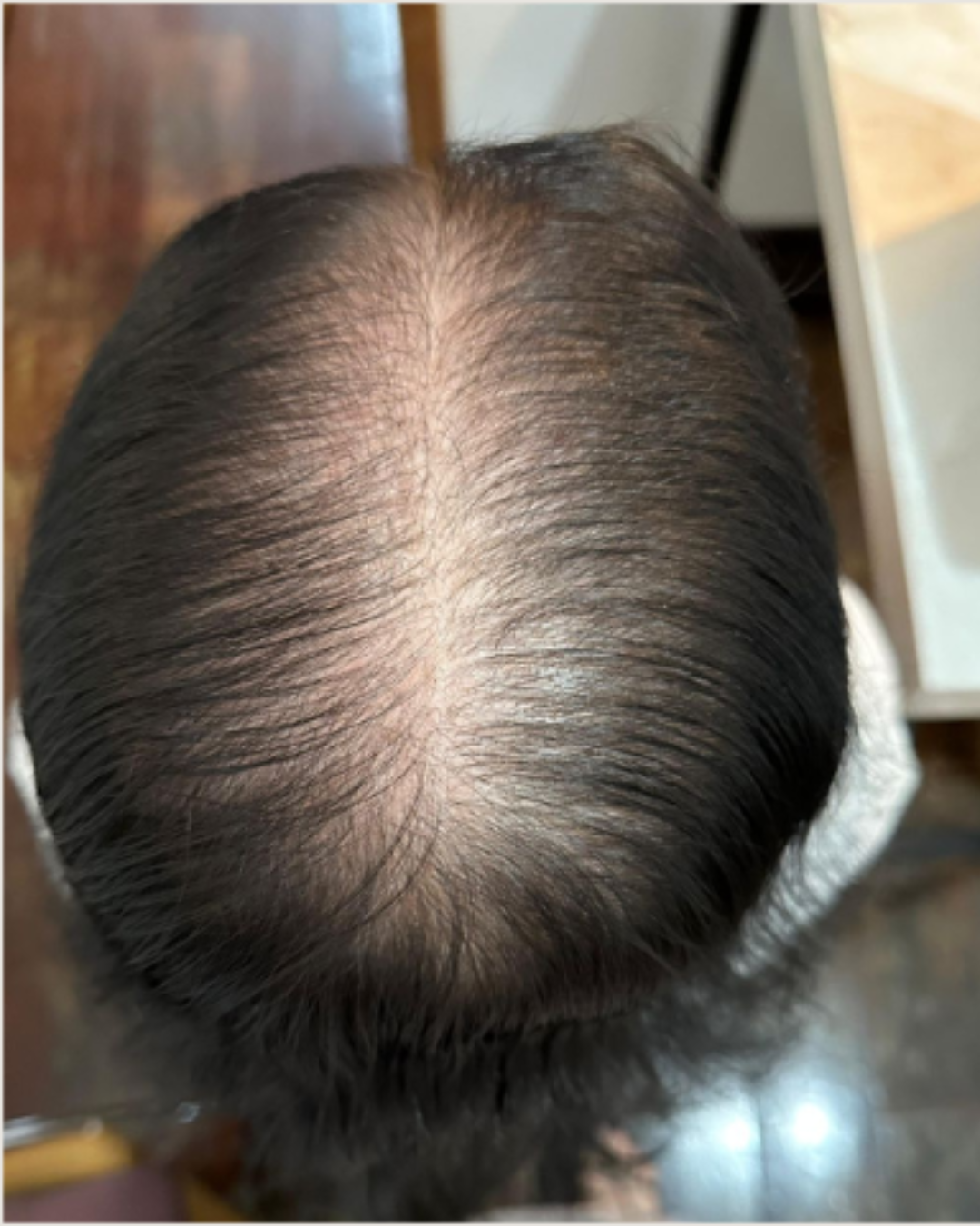 Tratamento capilar antes e depois (2)
