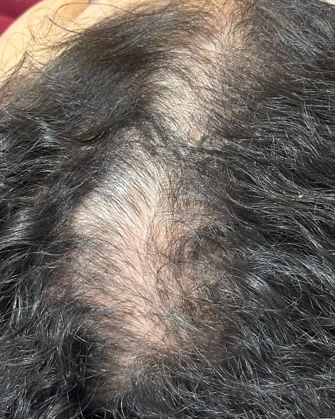 Tratamento capilar antes e depois (3)