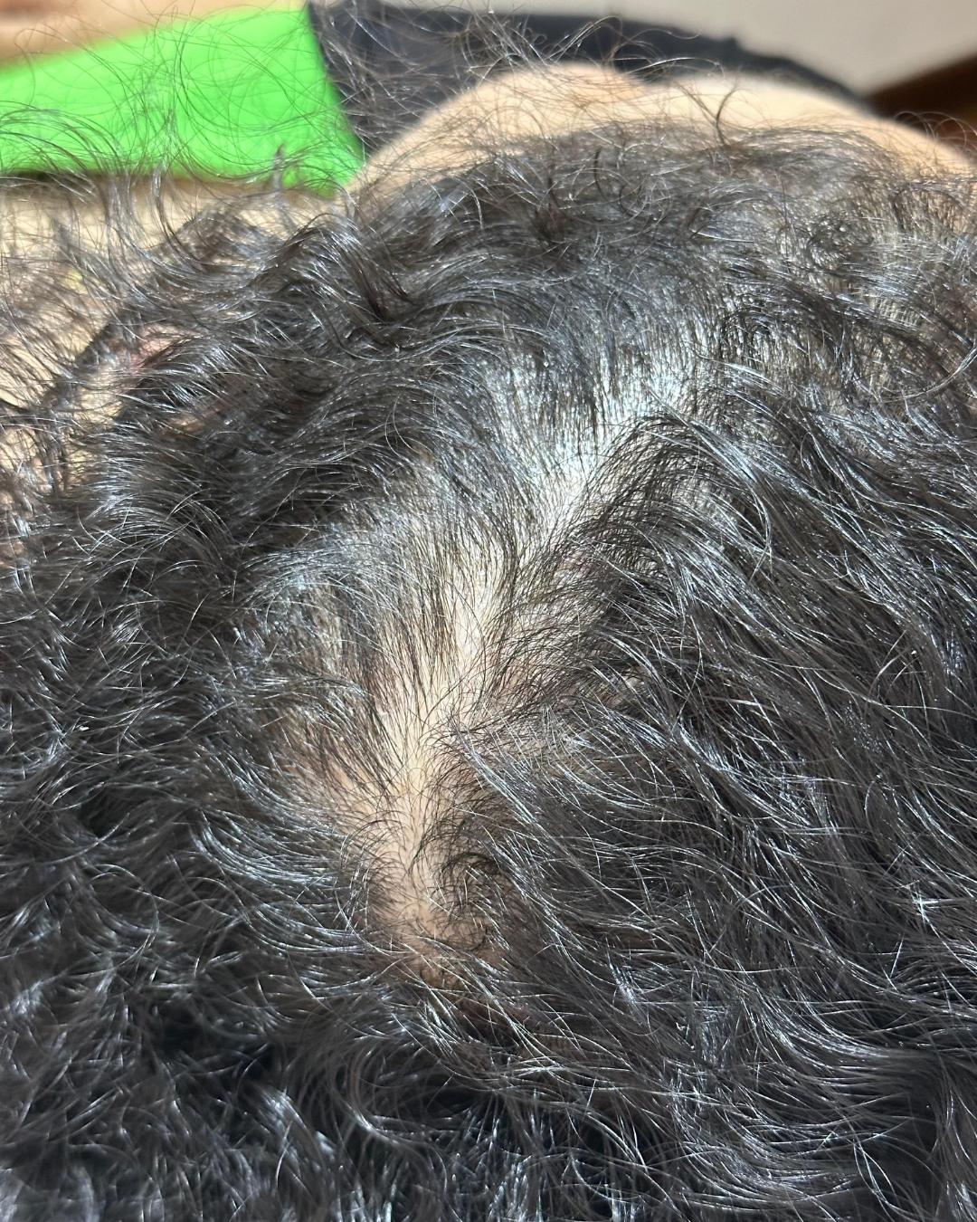 Tratamento capilar antes e depois (4)