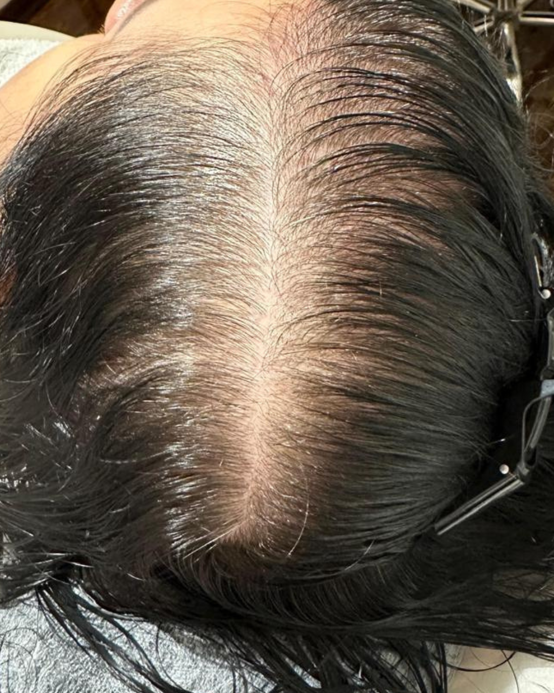 Tratamento capilar antes e depois (5)