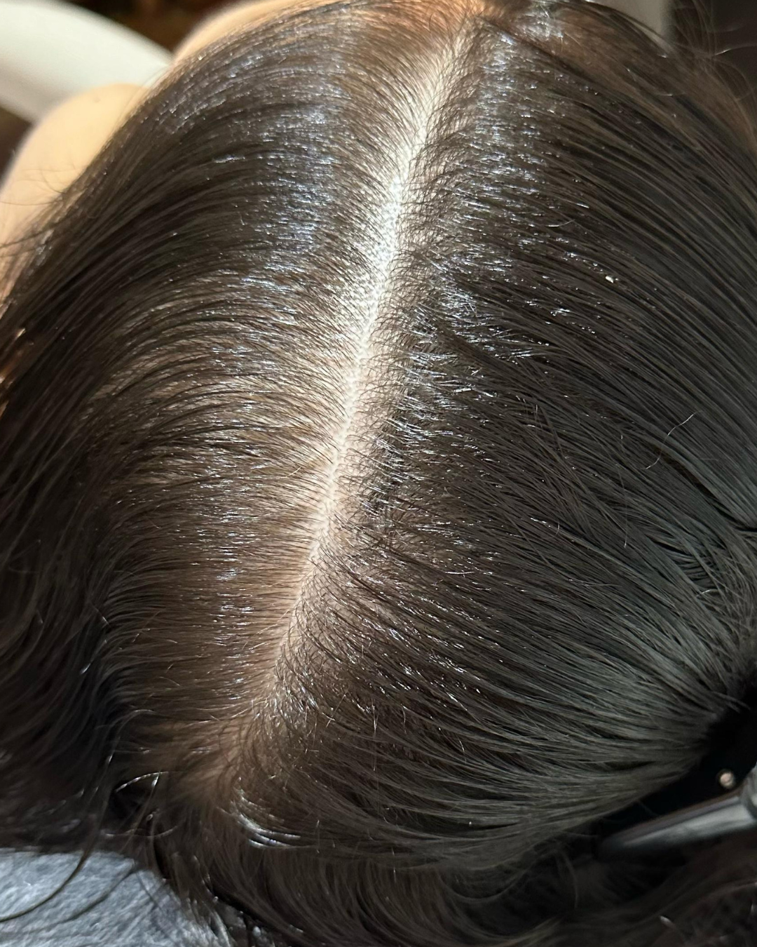 Tratamento capilar antes e depois (6)