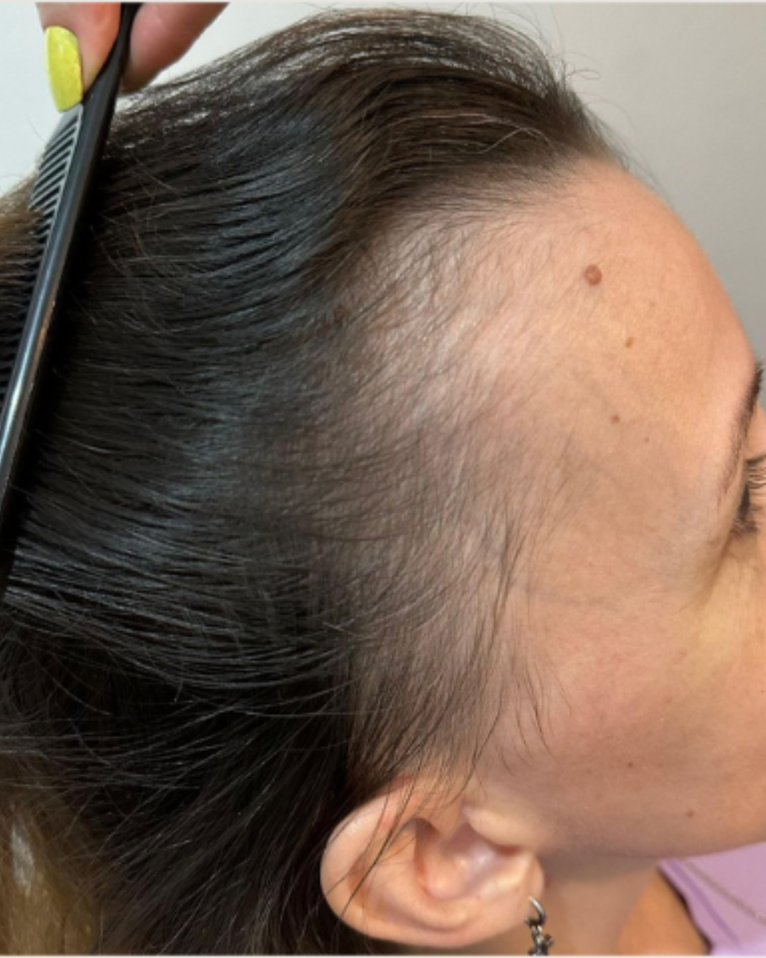 Tratamento capilar antes e depois (7)