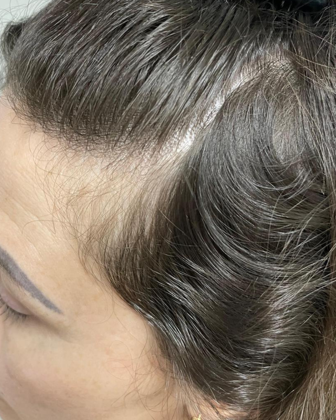 Tratamento capilar antes e depois (9)