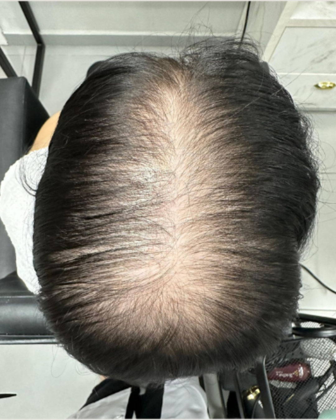 Tratamento capilar antes e depois